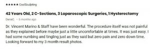 Coolsculpting Reviews