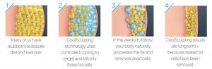 How Coolsculpting Works Web 1080X352