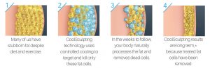 How Coolsculpting Works Web Min