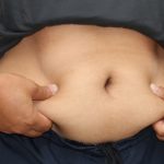 Pinching Belly Fat