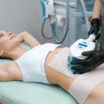 Does CoolSculpting® Hurt?